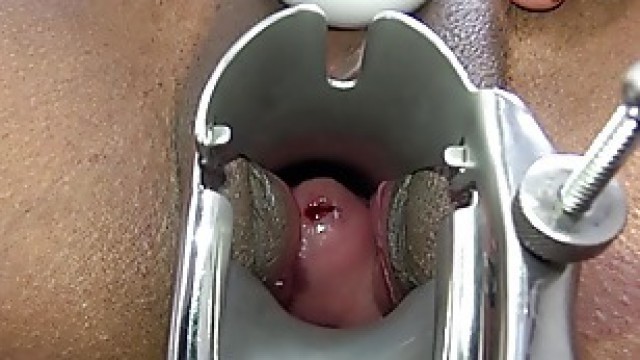 Gyno masturbation